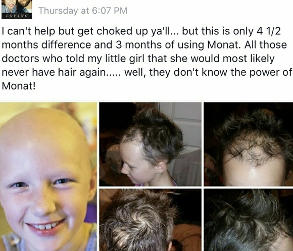 💥MONAT BOGO💥 - Picture 8 of 8